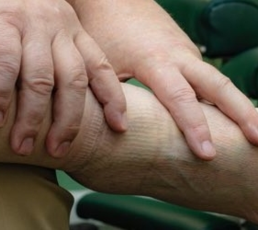 ankle sprain picture